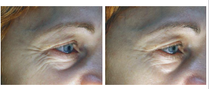 BA NeutralEyes (1)